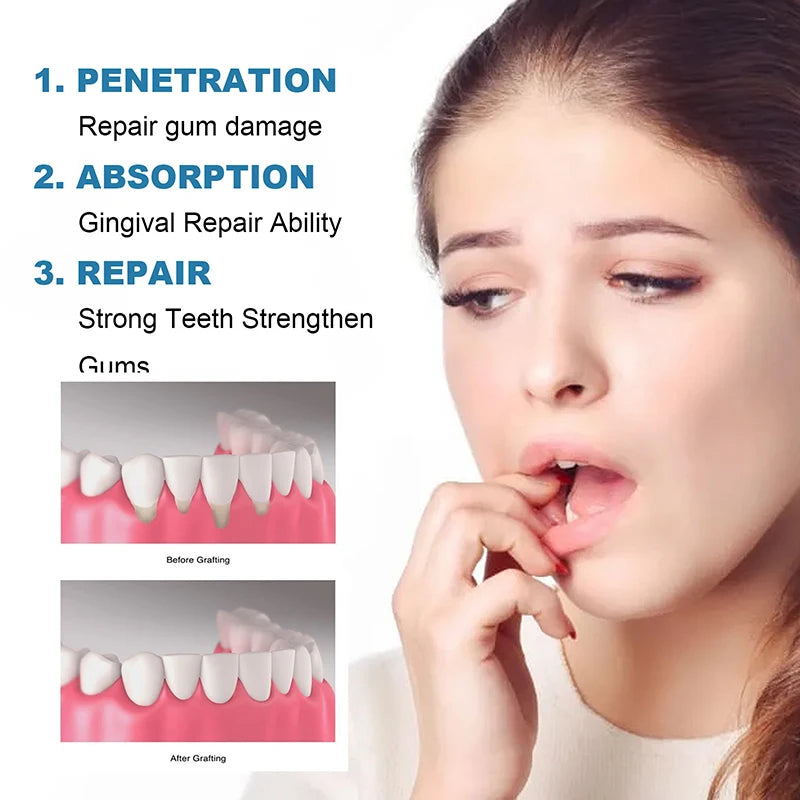 Rapid Repair Gums Serum Relieve Tooth Allergy Drops