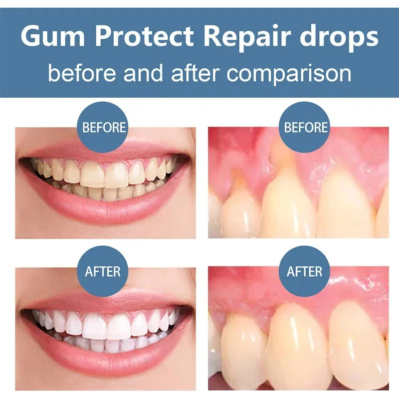 Rapid Repair Gums Serum Relieve Tooth Allergy Drops