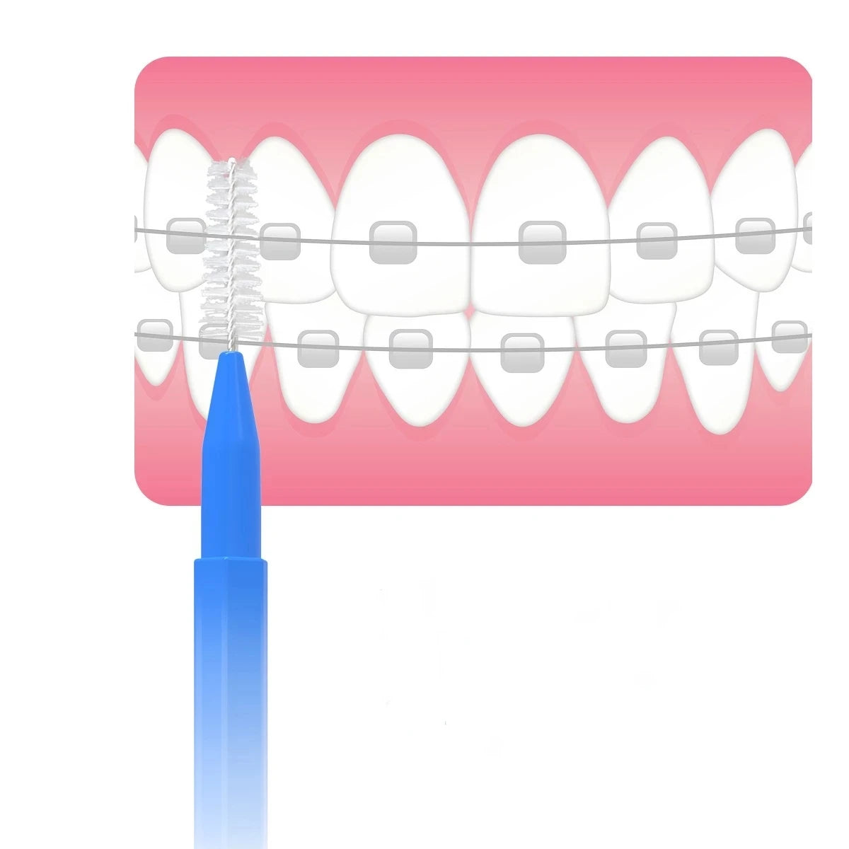 30pcs Premium Dental Picks Kit for Effective Oral Care