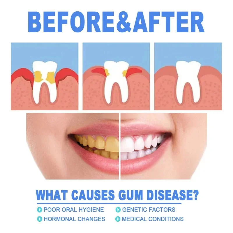 Rapid Repair Gums Serum Relieve Tooth Allergy and Damage