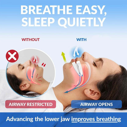 Adjustable Anti-Snoring Mouthguard for Nighttime Comfort and Bruxism Relief