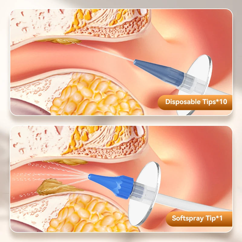 Ear Wax Removal Manual Ear Irrigation Flushing System Ear Wax Clean Tool Safe and Effective Ear Water Cleaner Kit