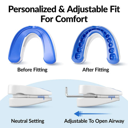 Adjustable Anti-Snoring Mouthguard for Nighttime Comfort and Bruxism Relief