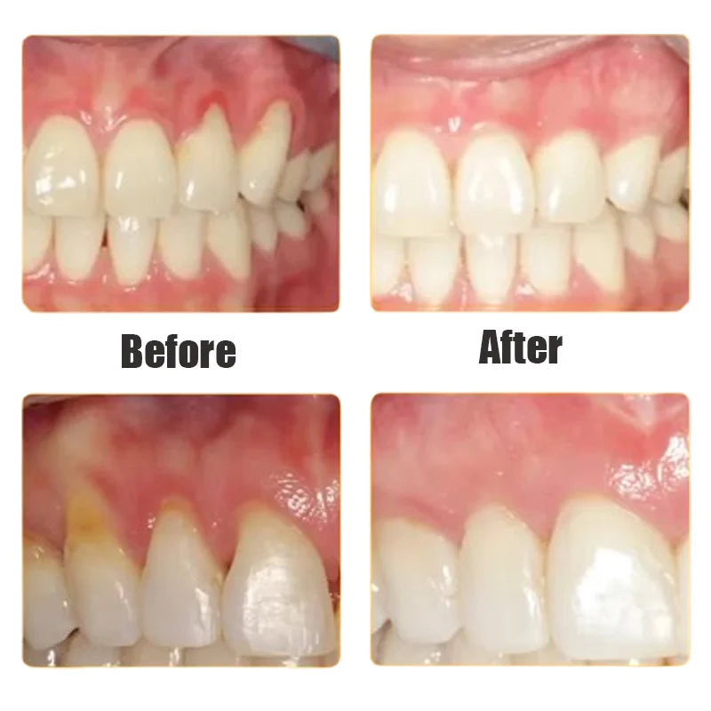 Rapid Repair Gums Serum Relieve Tooth Allergy Drops