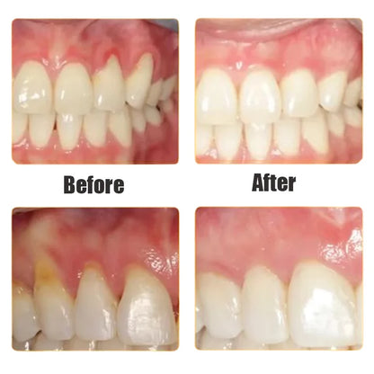 Rapid Repair Gums Serum Relieve Tooth Allergy Drops
